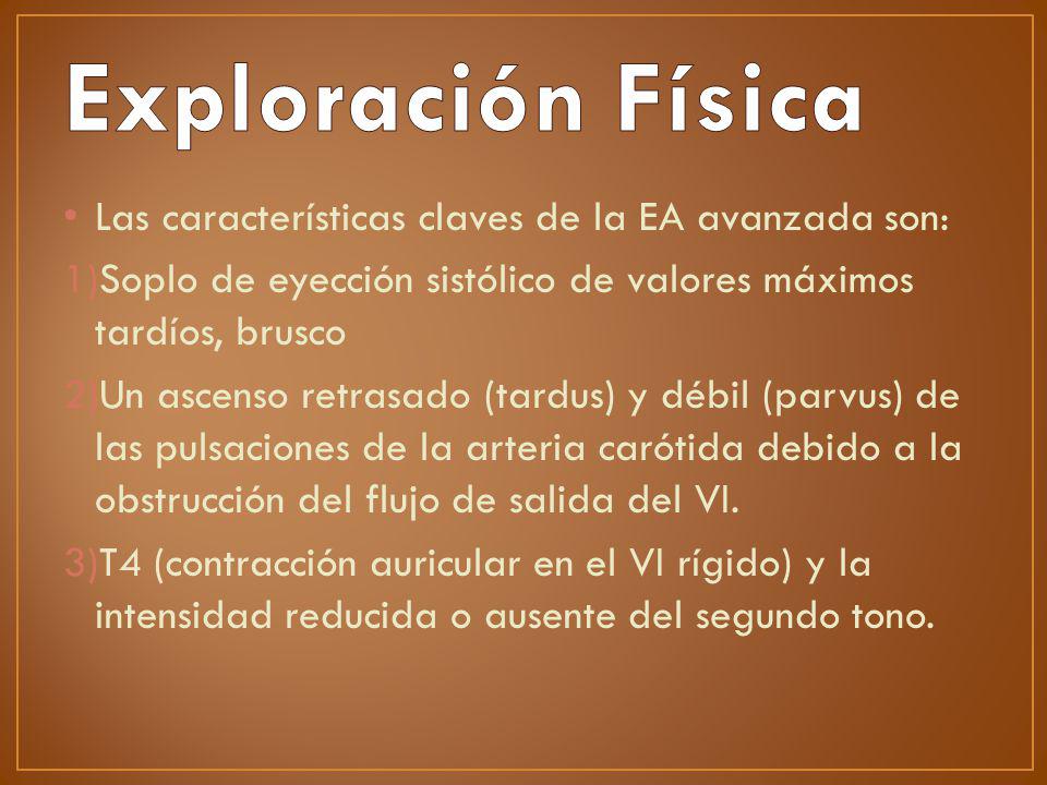 Exploración Física Las características claves de la EA avanzada son: