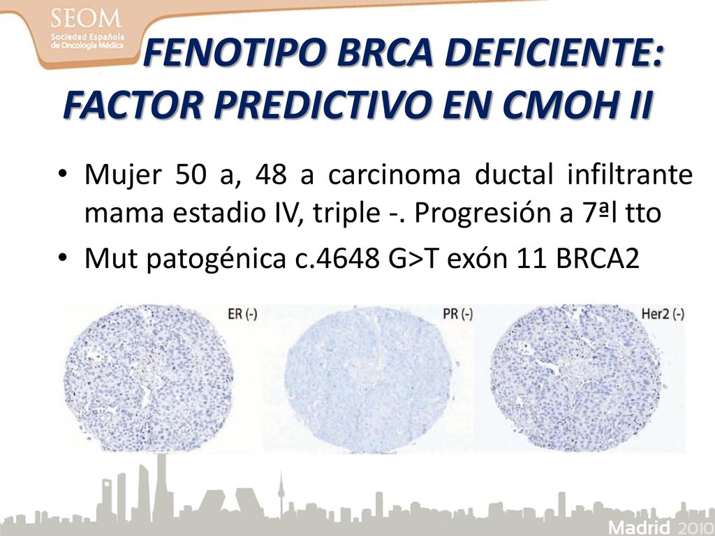 FENOTIPO BRCA DEFICIENTE: FACTOR PREDICTIVO EN CMOH II