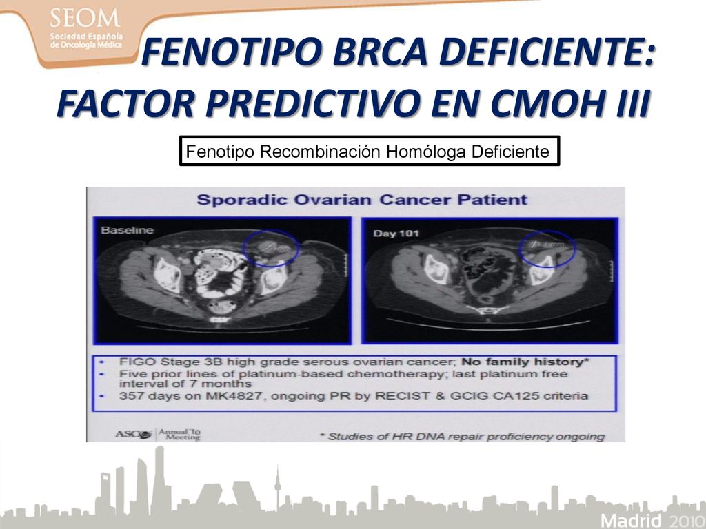 FENOTIPO BRCA DEFICIENTE: FACTOR PREDICTIVO EN CMOH III