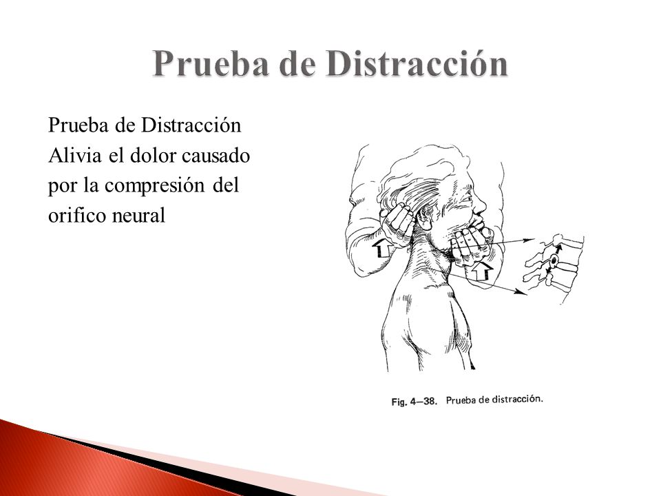 Prueba de Distracción Prueba de Distracción Alivia el dolor causado por la compresión del orifico neural