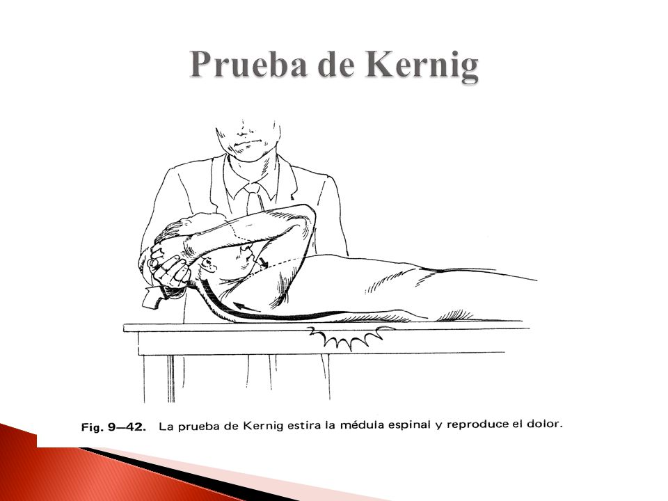 Prueba de Kernig Kernig para ver compresión radicular igual que la C pero se tracciona la médula para arriba y no para abajo.