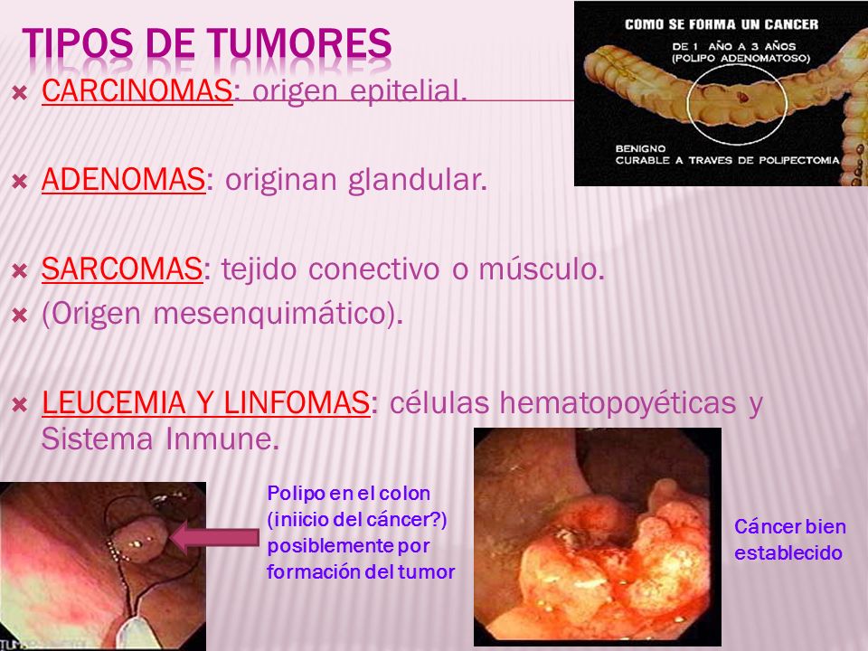 TIPOS DE TUMORES CARCINOMAS: origen epitelial.
