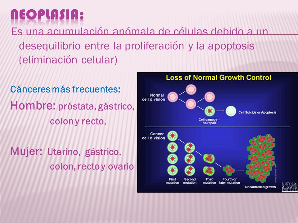 NEOPLASIA: Es una acumulación anómala de células debido a un desequilibrio entre la proliferación y la apoptosis (eliminación celular)