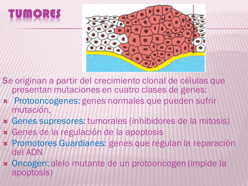 Tumores Se originan a partir del crecimiento clonal de células que presentan mutaciones en cuatro clases de genes: