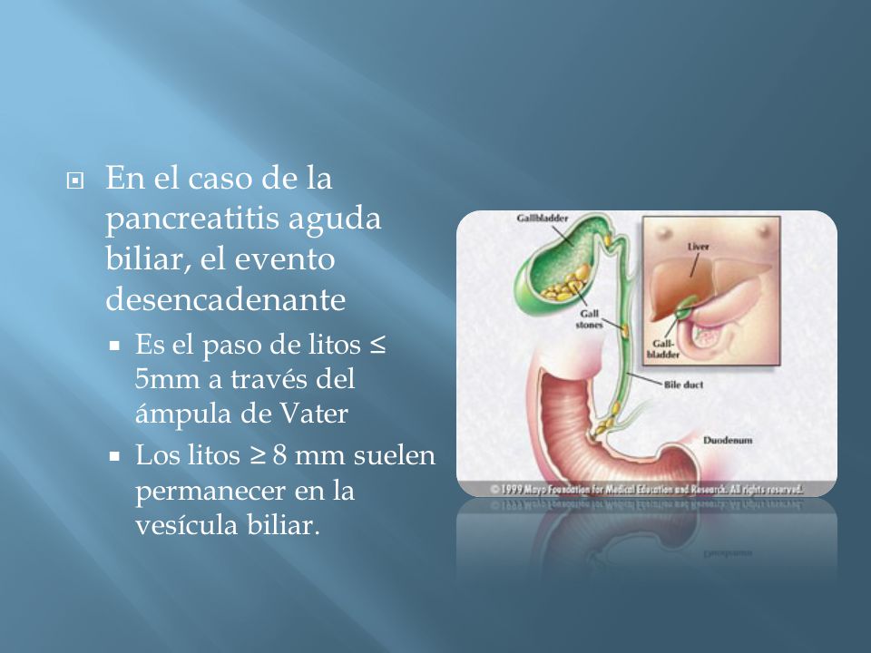 En el caso de la pancreatitis aguda biliar, el evento desencadenante