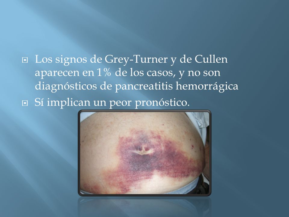 Los signos de Grey-Turner y de Cullen aparecen en 1% de los casos, y no son diagnósticos de pancreatitis hemorrágica