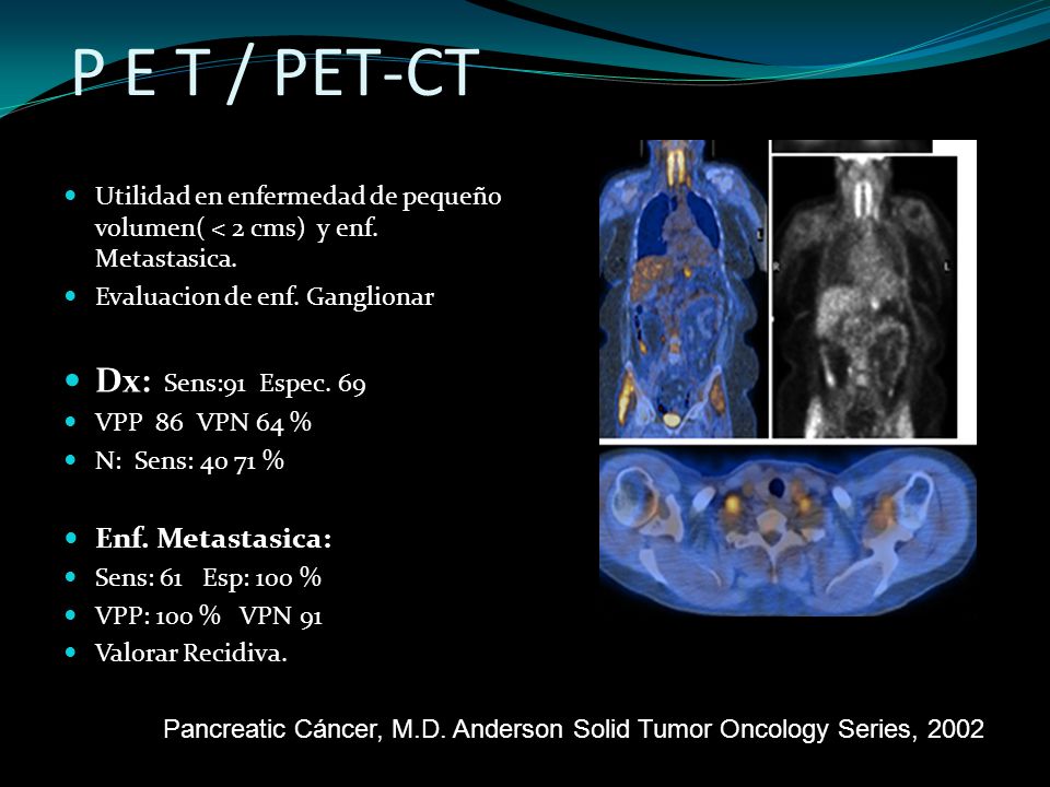 P E T / PET-CT Dx: Sens:91 Espec. 69 Enf. Metastasica: