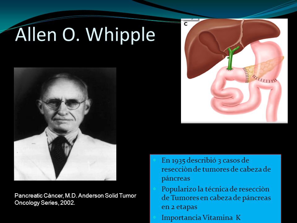 Allen O. Whipple En 1935 describió 3 casos de resecciòn de tumores de cabeza de páncreas.