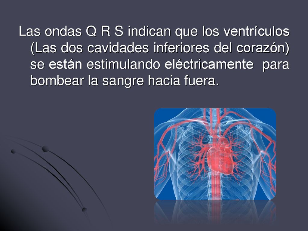Las ondas Q R S indican que los ventrículos (Las dos cavidades inferiores del corazón) se están estimulando eléctricamente para bombear la sangre hacia fuera.
