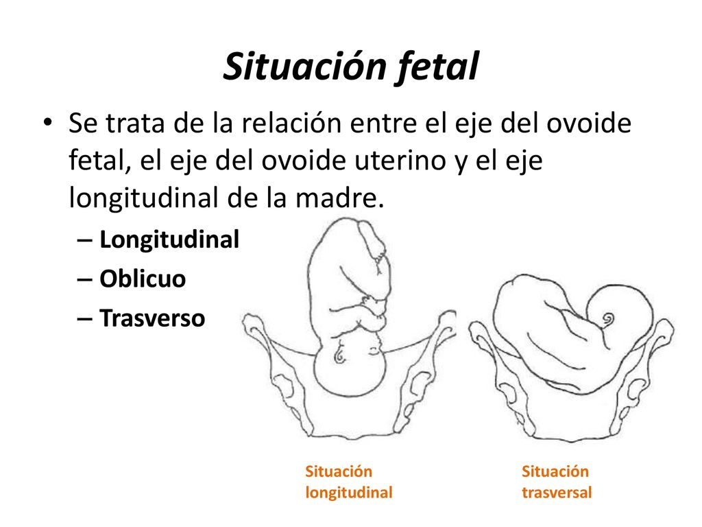 Situación fetal Se trata de la relación entre el eje del ovoide fetal, el eje del ovoide uterino y el eje longitudinal de la madre.