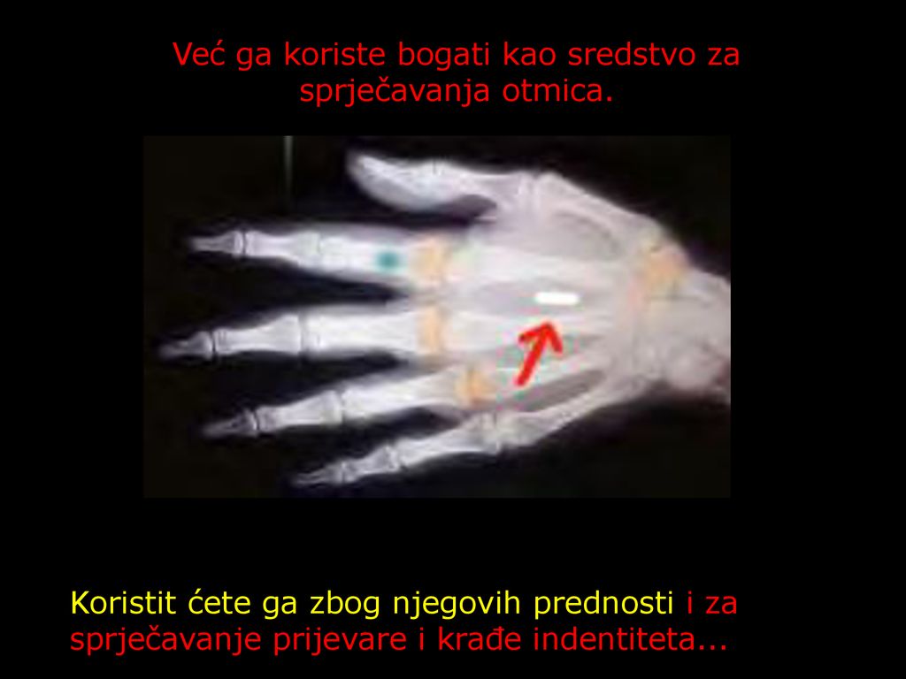 Već ga koriste bogati kao sredstvo za sprječavanja otmica.