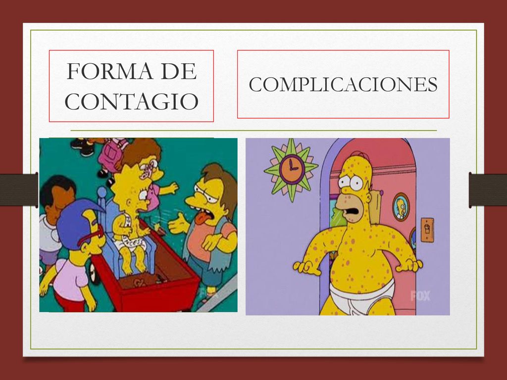 FORMA DE CONTAGIO COMPLICACIONES