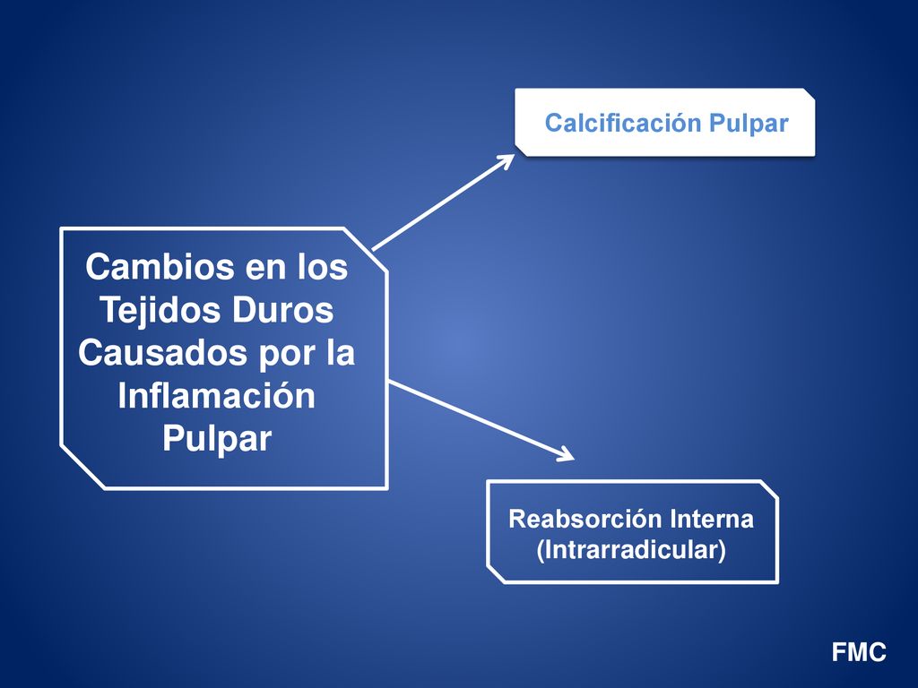 Cambios en los Tejidos Duros Causados por la Inflamación Pulpar