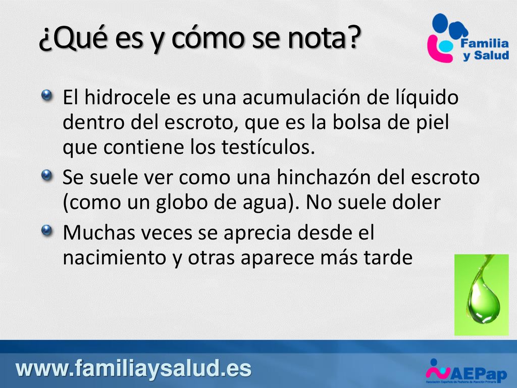 ¿Qué es y cómo se nota El hidrocele es una acumulación de líquido dentro del escroto, que es la bolsa de piel que contiene los testículos.