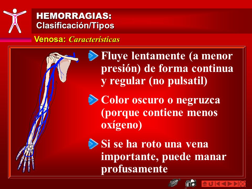 Color oscuro o negruzca (porque contiene menos oxígeno)