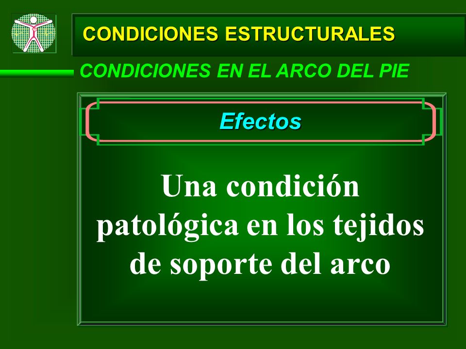 Una condición patológica en los tejidos de soporte del arco
