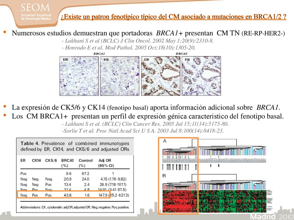 ¿Existe un patron fenotípico típico del CM asociado a mutaciones en BRCA1/2