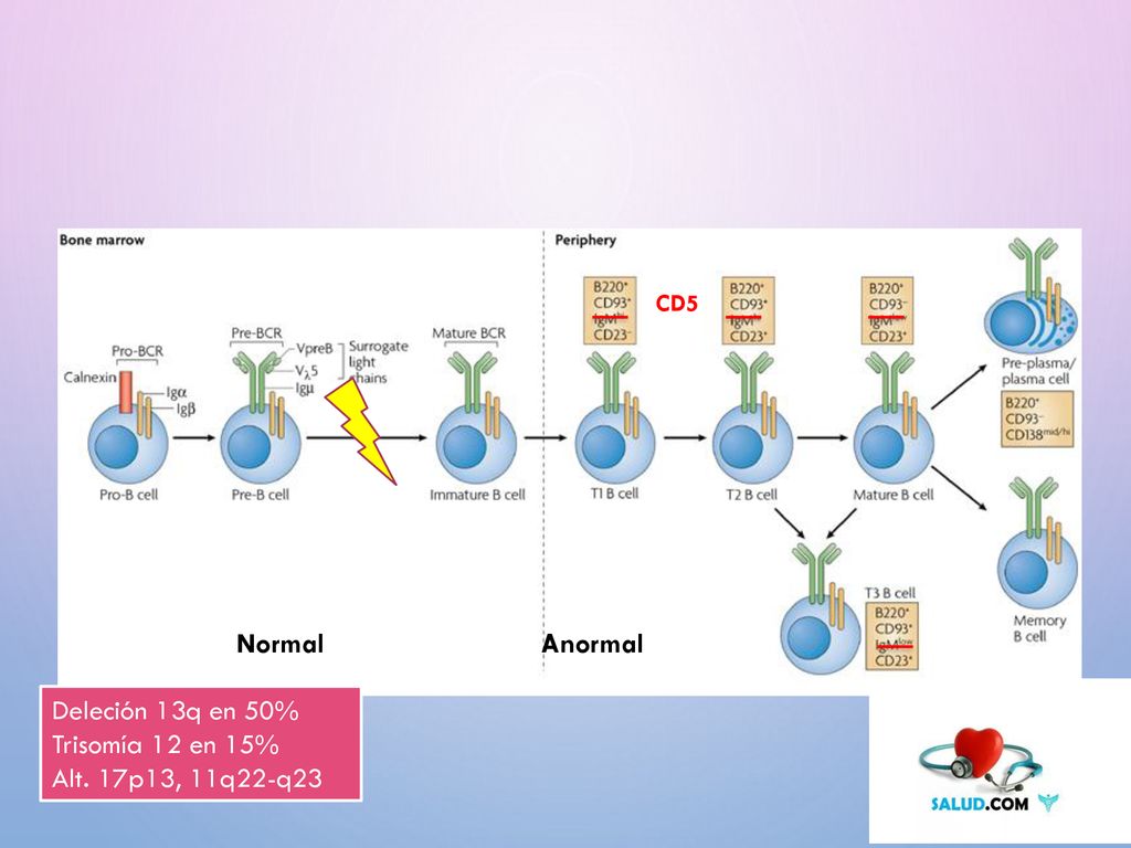 Normal Anormal Deleción 13q en 50% Trisomía 12 en 15%