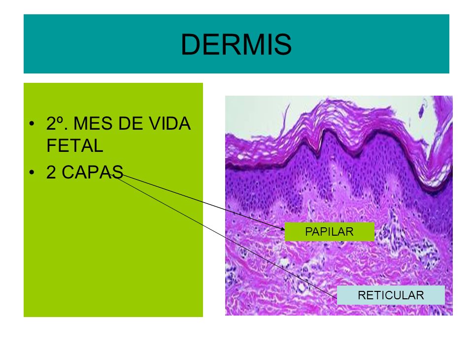 DERMIS 2º. MES DE VIDA FETAL 2 CAPAS PAPILAR PAPILAR RETICULAR