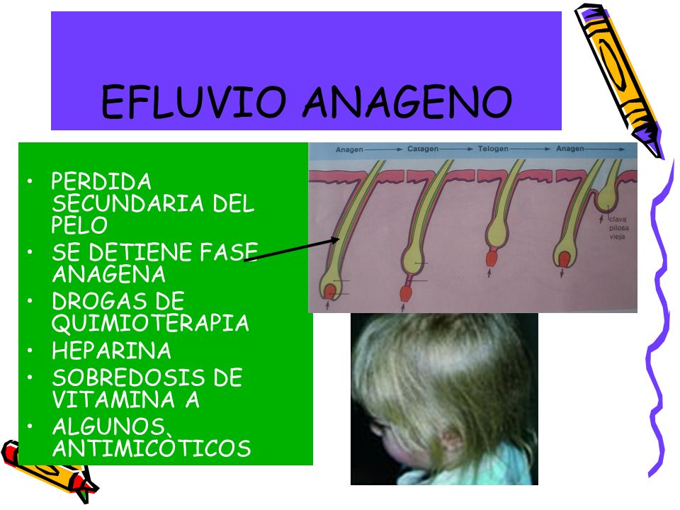 EFLUVIO ANAGENO PERDIDA SECUNDARIA DEL PELO SE DETIENE FASE ANAGENA