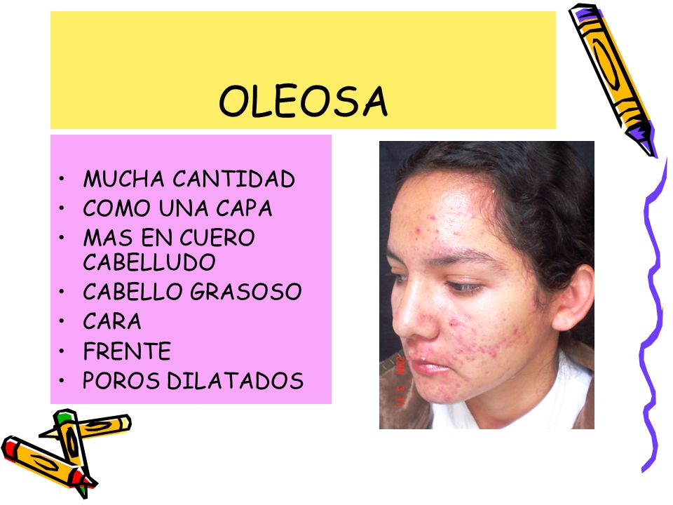 OLEOSA MUCHA CANTIDAD COMO UNA CAPA MAS EN CUERO CABELLUDO