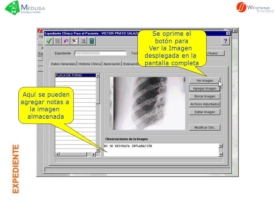 EXPEDIENTE Se oprime el botón para Ver la Imagen desplegada en la