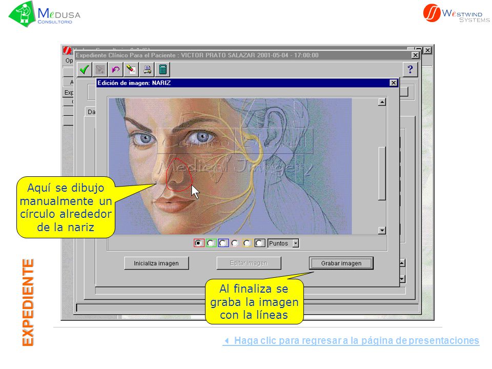 EXPEDIENTE Aquí se dibujo manualmente un círculo alrededor de la nariz