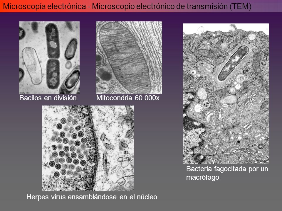 Microscopía y técnicas de estudio a nivel celular - ppt video online  descargar