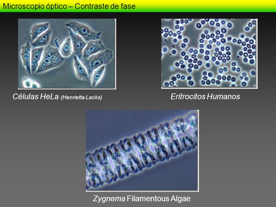 MICROSCOPíA Y TÉCNICAS DE ESTUDIO CELULAR - ppt descargar