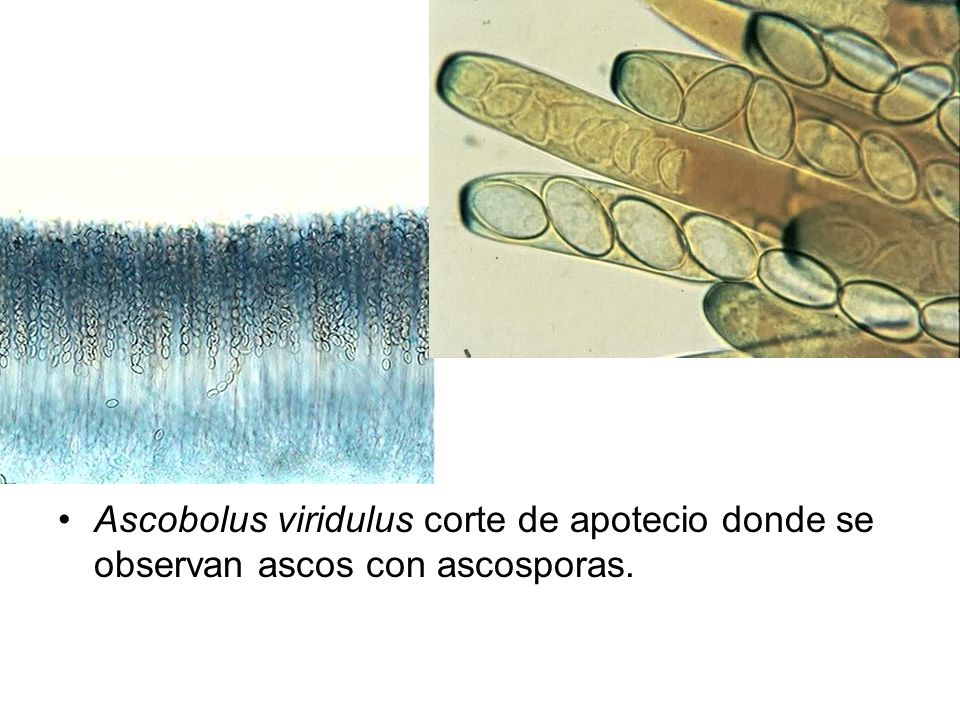Ascobolus viridulus corte de apotecio donde se observan ascos con ascosporas.