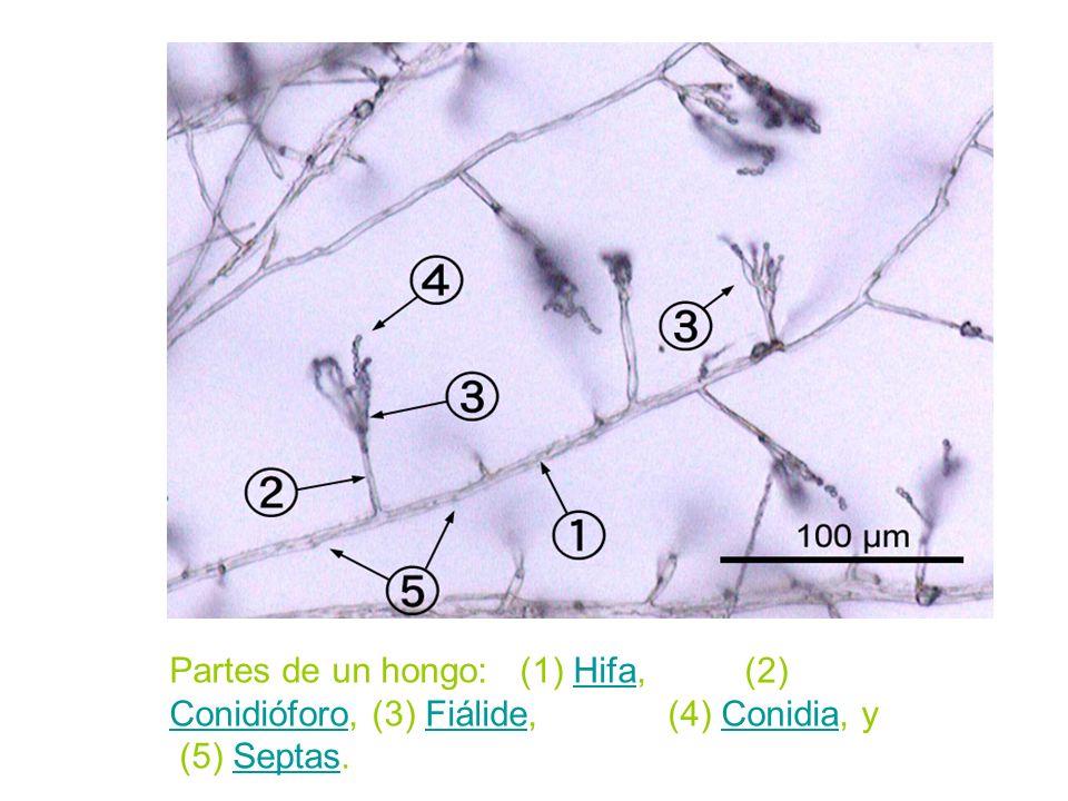 Partes de un hongo: (1) Hifa, (2) Conidióforo, (3) Fiálide, (4) Conidia, y