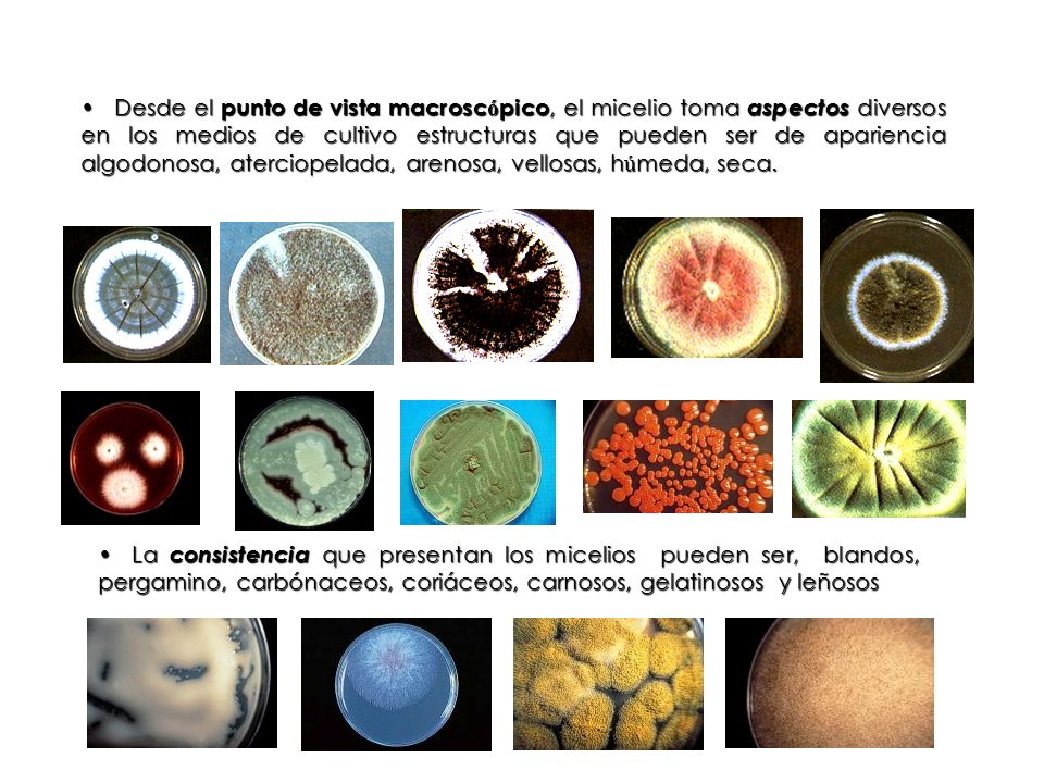 Desde el punto de vista macroscópico, el micelio toma aspectos diversos en los medios de cultivo estructuras que pueden ser de apariencia algodonosa, aterciopelada, arenosa, vellosas, húmeda, seca.