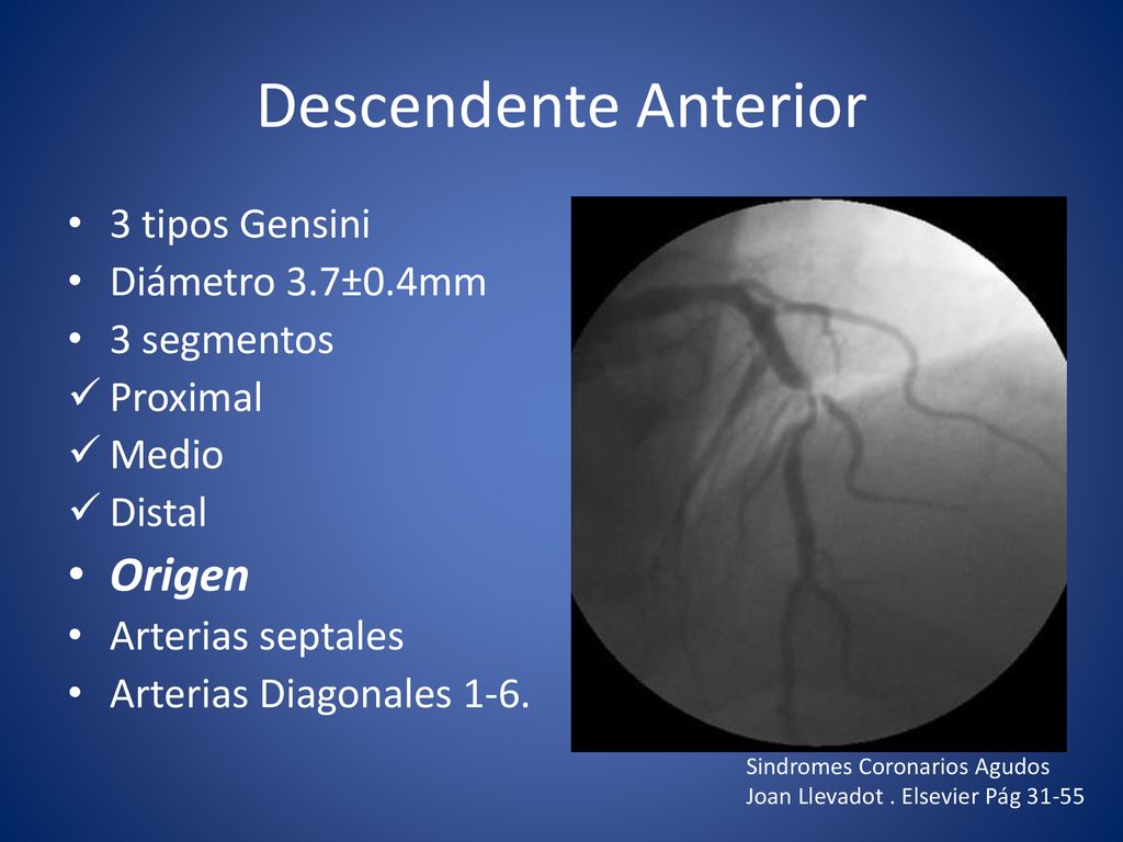 Descendente Anterior Origen 3 tipos Gensini Diámetro 3.7±0.4mm