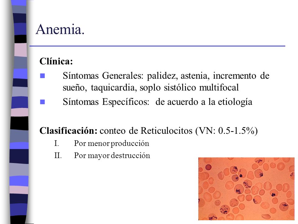 Anemia. Clínica: Síntomas Generales: palidez, astenia, incremento de sueño, taquicardia, soplo sistólico multifocal.