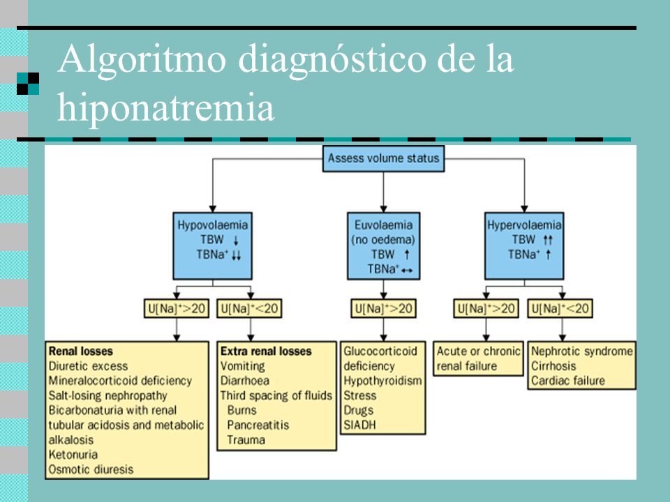 Algoritmo diagnóstico de la hiponatremia