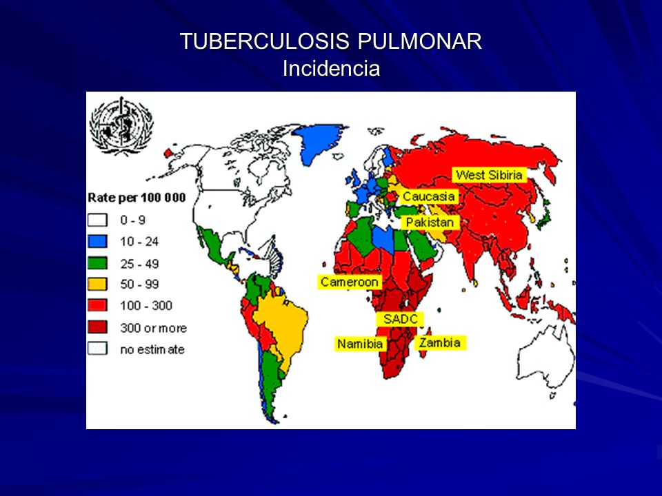 TUBERCULOSIS PULMONAR