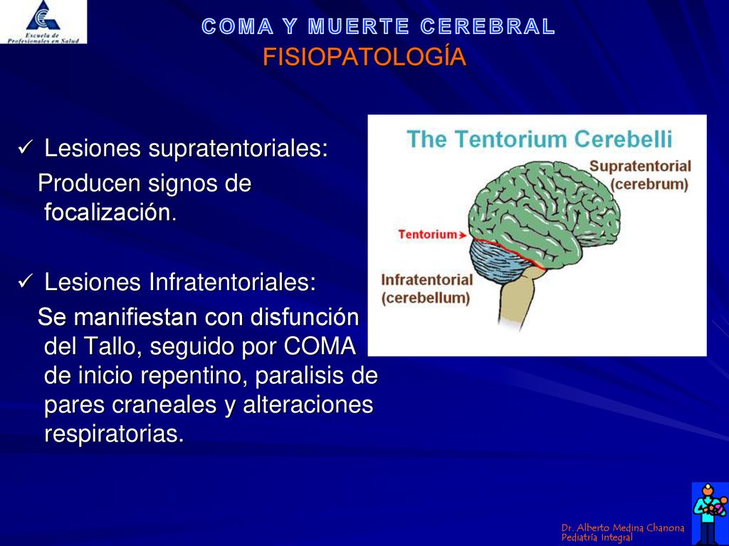 FISIOPATOLOGÍA Lesiones supratentoriales: Producen signos de focalización. Lesiones Infratentoriales: