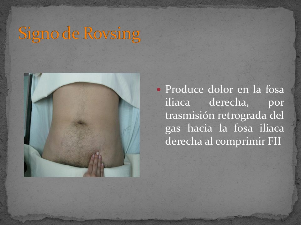 Signo de Rovsing Produce dolor en la fosa iliaca derecha, por trasmisión retrograda del gas hacia la fosa iliaca derecha al comprimir FII.