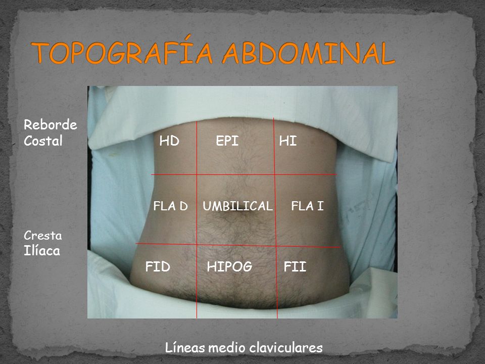 TOPOGRAFÍA ABDOMINAL Reborde Costal HD EPI HI FLA D UMBILICAL FLA I