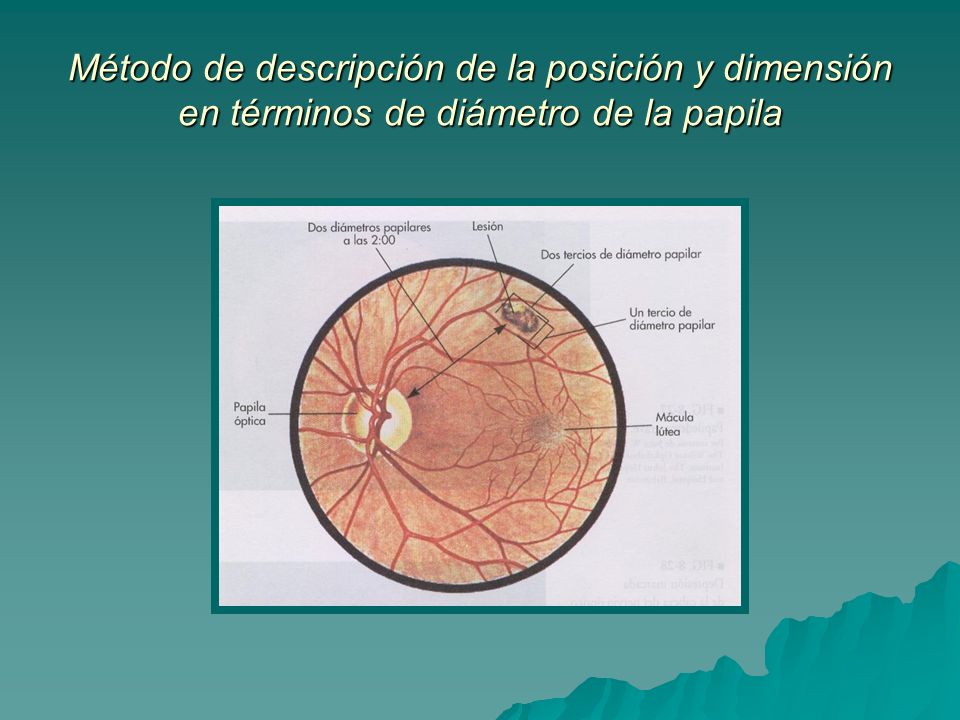 Método de descripción de la posición y dimensión en términos de diámetro de la papila