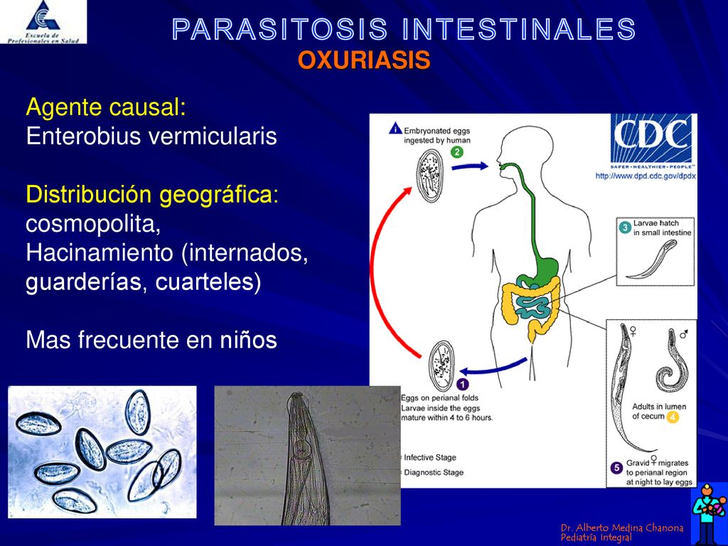 OXURIASIS Agente causal: Enterobius vermicularis Distribución geográfica: cosmopolita, Hacinamiento (internados, guarderías, cuarteles)