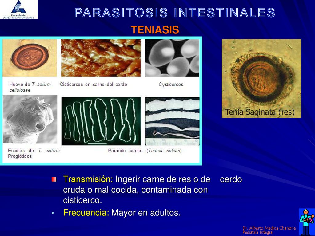 TENIASIS Tenia Saginata (res) Transmisión: Ingerir carne de res o de cerdo cruda o mal cocida, contaminada con cisticerco.