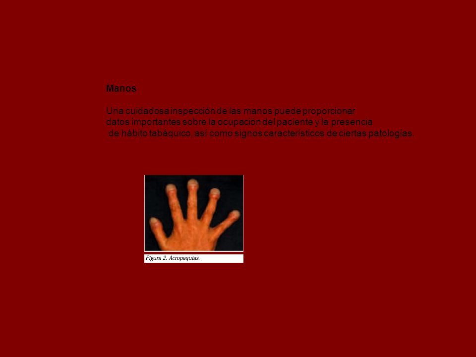 Manos Una cuidadosa inspección de las manos puede proporcionar