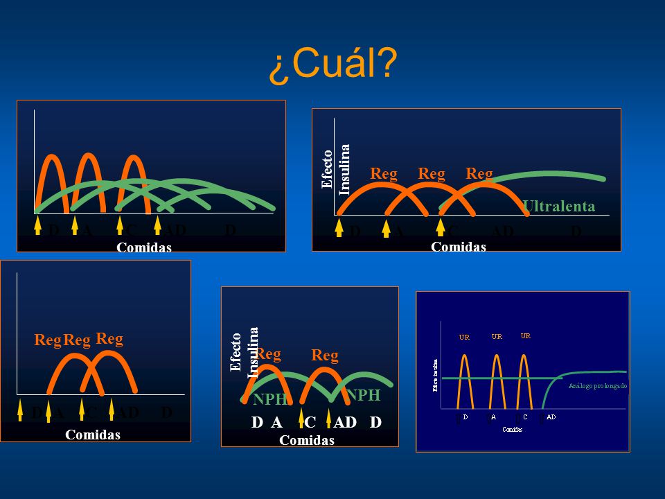 ¿Cuál D A C AD D A C AD Reg Ultralenta D A C AD Reg D A C AD Reg NPH