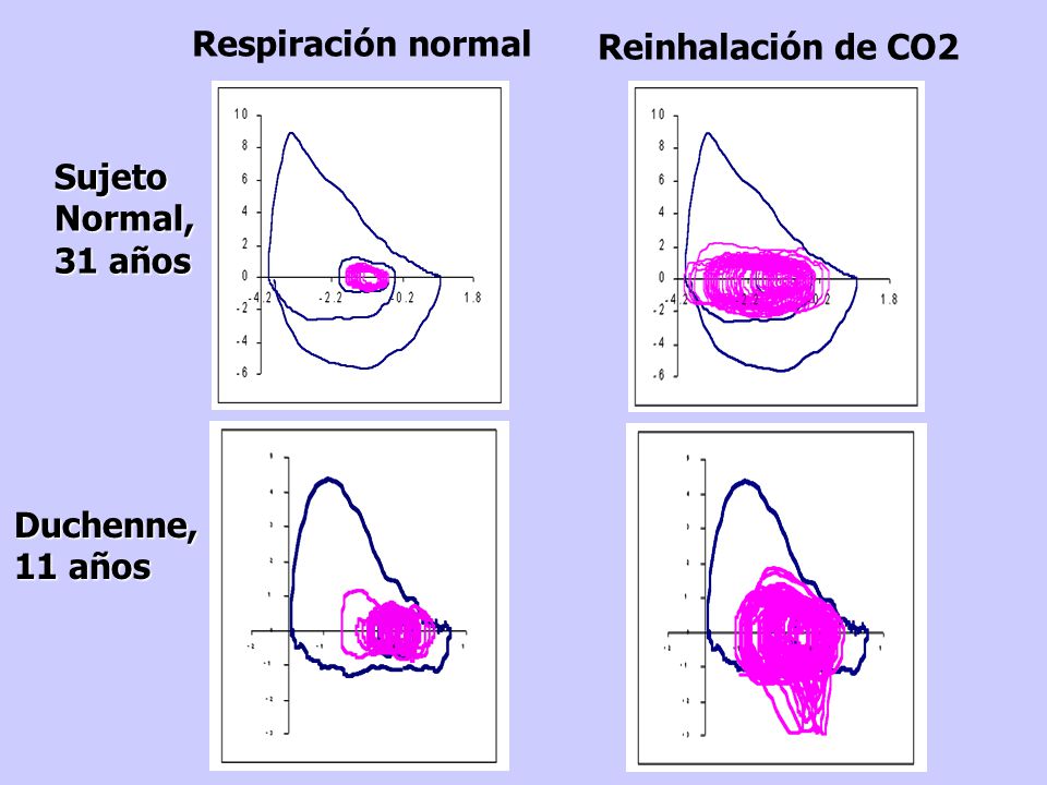 Reinhalación de CO2 Respiración normal Sujeto Normal, 31 años Duchenne, 11 años