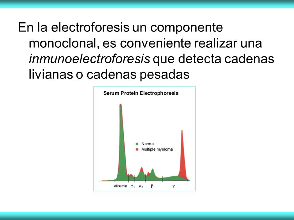 En la electroforesis un componente monoclonal, es conveniente realizar una inmunoelectroforesis que detecta cadenas livianas o cadenas pesadas