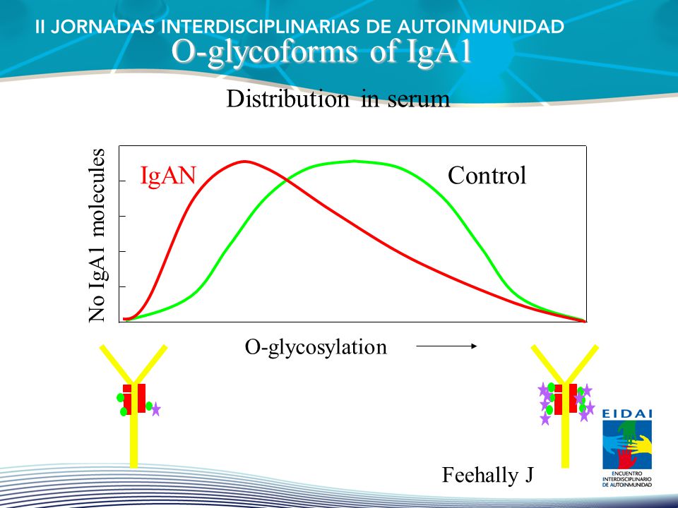 O-glycoforms of IgA1 Distribution in serum IgAN Control High Low