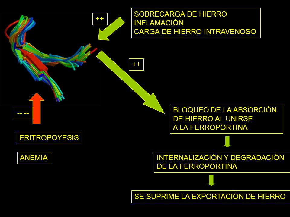SOBRECARGA DE HIERRO INFLAMACIÓN. CARGA DE HIERRO INTRAVENOSO BLOQUEO DE LA ABSORCIÓN. DE HIERRO AL UNIRSE.