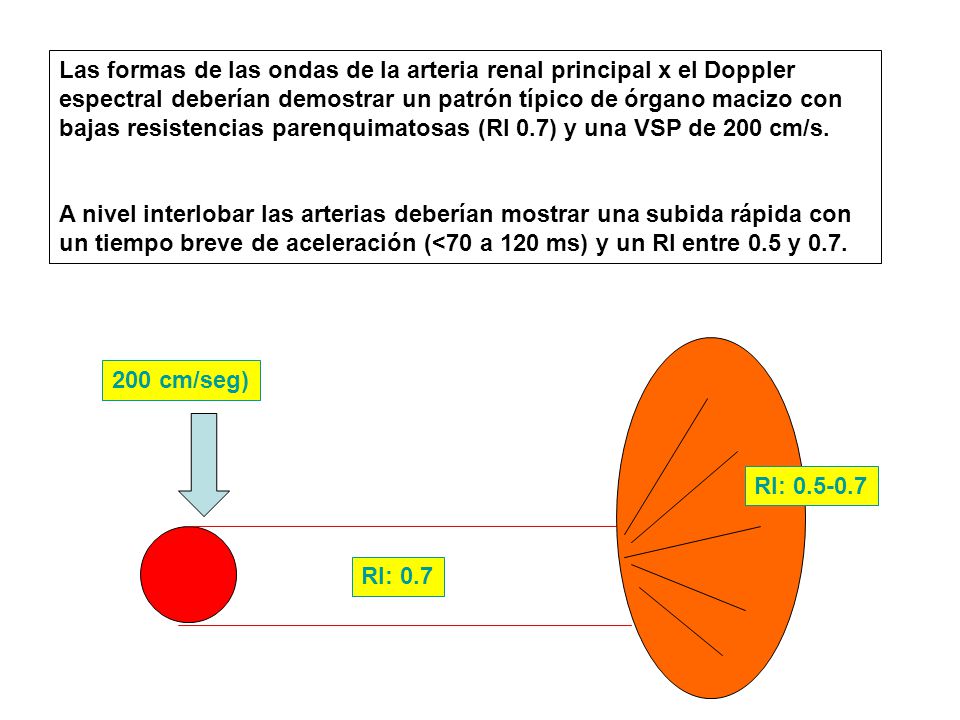 Las formas de las ondas de la arteria renal principal x el Doppler espectral deberían demostrar un patrón típico de órgano macizo con bajas resistencias parenquimatosas (RI 0.7) y una VSP de 200 cm/s.