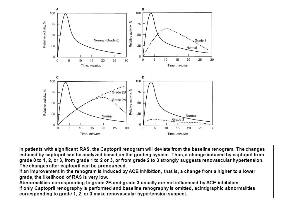 In patients with significant RAS, the Captopril renogram will deviate from the baseline renogram. The changes induced by captopril can be analyzed based on the grading system. Thus, a change induced by captopril from grade 0 to 1, 2, or 3, from grade 1 to 2 or 3, or from grade 2 to 3 strongly suggests renovascular hypertension.